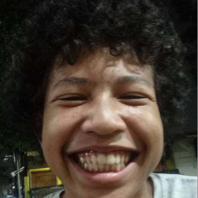 

Jhonson babi