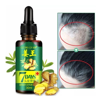 Rambut-Serum-Vitamin- 7 Days Clothes Of Skin Minyak Penumbuh Rambut Ginger Germinal Oil 30Ml - 30 Ml
