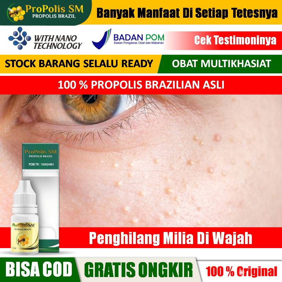 Obat Tetes Milia, Milia Di Wajah, Milia Di Jidat, Penghilang Milia Di Wajah, Bintik Bintik Di Bawah,