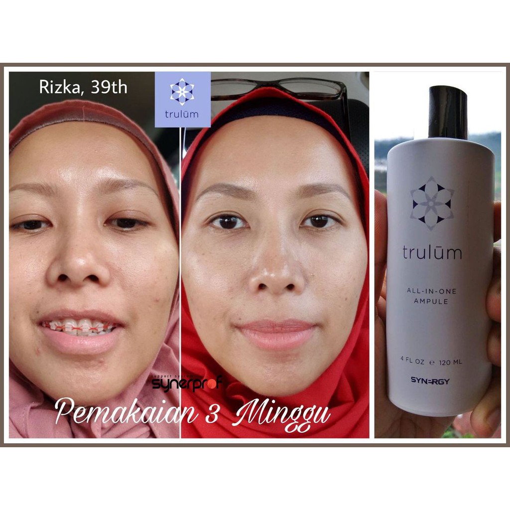 «409³ Skincare Pemutih Aman | Serum Untuk Menghilangkan Melasma Noda Dan Flek Hitam Di Wajah Trulum