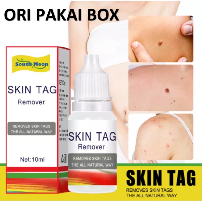 SKIN TAG Obat Penghilang Kutil Tahi Lalat Papiloma