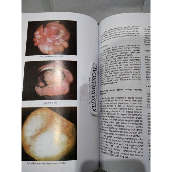 BUKU AJAR ILMU KESEHATAN TELINGA HIDUNG TENGGOROKAN KEPALA&amp;LEHER (THT) TERMURAH LARIS