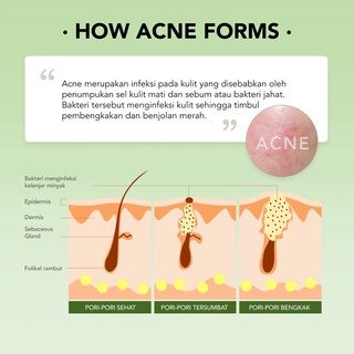 YOU Acneplus Niacinamide + 4D Centella Rapid Acne Removal Spot Care 15 gr Obat Jerawat-ORIGINAL-TARABABYSTORE