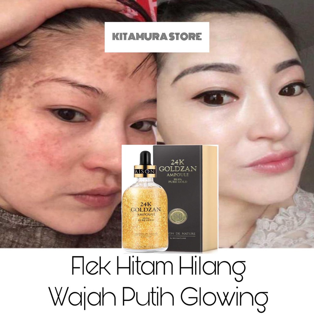 SERUM PEMUTIH KULIT WAJAH MENCERAHKAN KULIT WAJAH PEMUTIH INSTAN MENGHILANGKAN FLEK HITAM