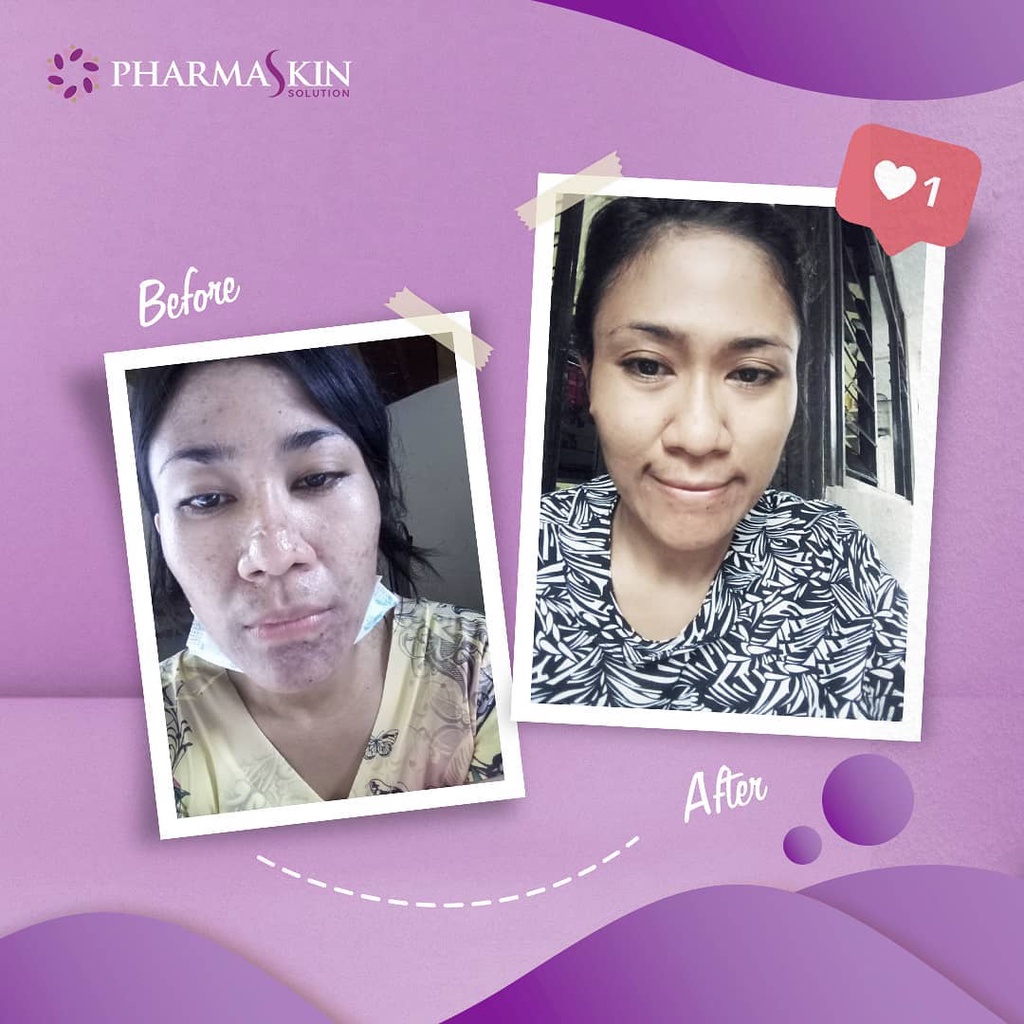 Pharmaskin Paket Full Treatment Acne Glowing Series Bebas Menghilangkan Jerawat Perawatan Wajah Berjerawat Glowing Ampuh Resmi BPOM Halal Original-3