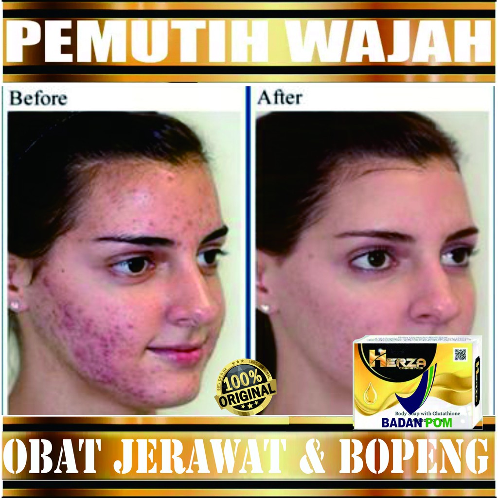 PEMUTIH WAJAH KULIT PRIA WANITA SABUN HERZA COLLAGEN BPOM OBAT JERAWAT BOPENG MENGHALUSKAN GLUTA MEN