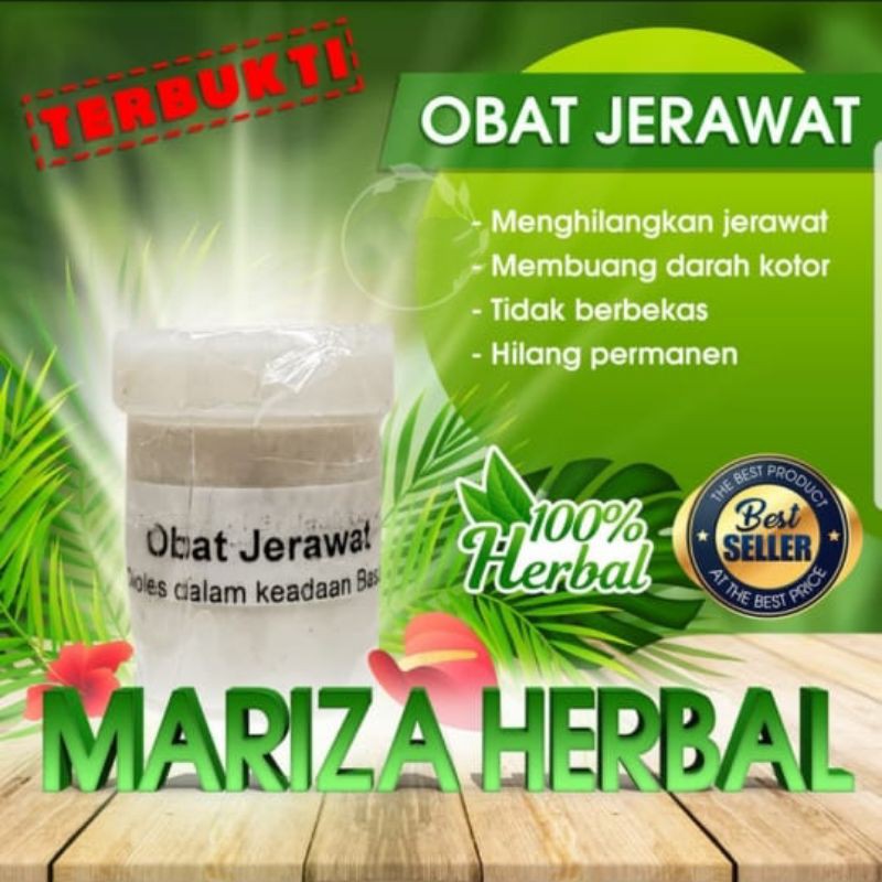 obat jerawat mariza herbal