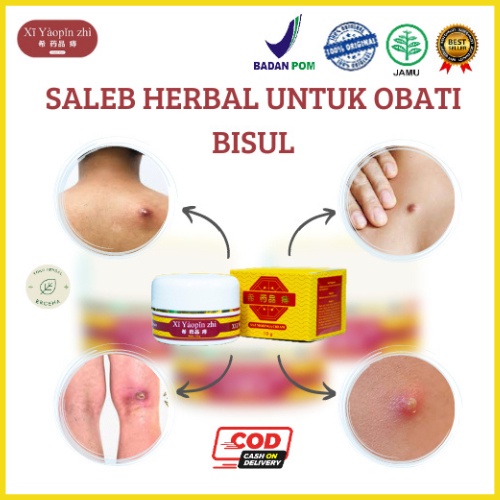 Salep Bisul Selangkangan Xi Yaopin Zhi Krim Wudun Saleb Bisulan Paling Manjur Salep Bisul Dubur Kelamin Selangkangan Ketiak Ampuh Tanpa Efek Samping BPOM Bisa COD