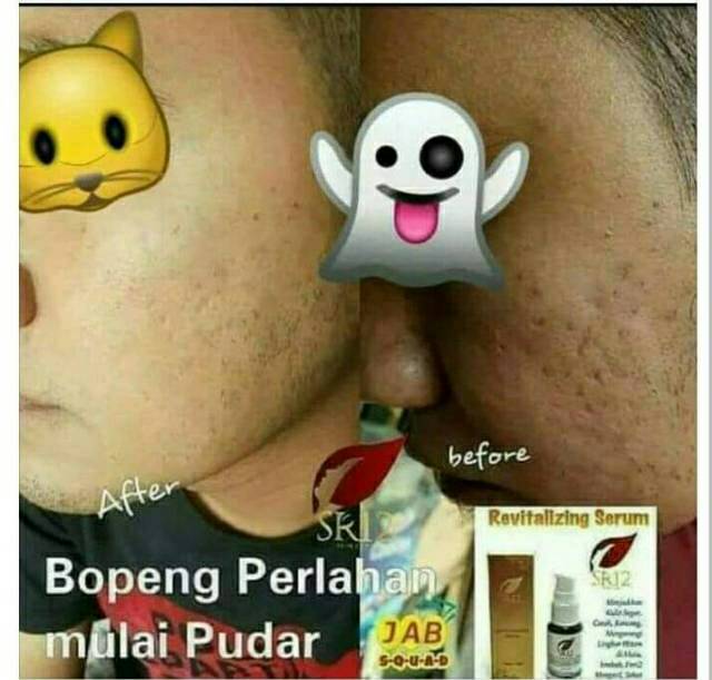 REVILATIZING SERUM SR12 / ATASI BOPENG, MATA PANDA, MENCERAHKAN