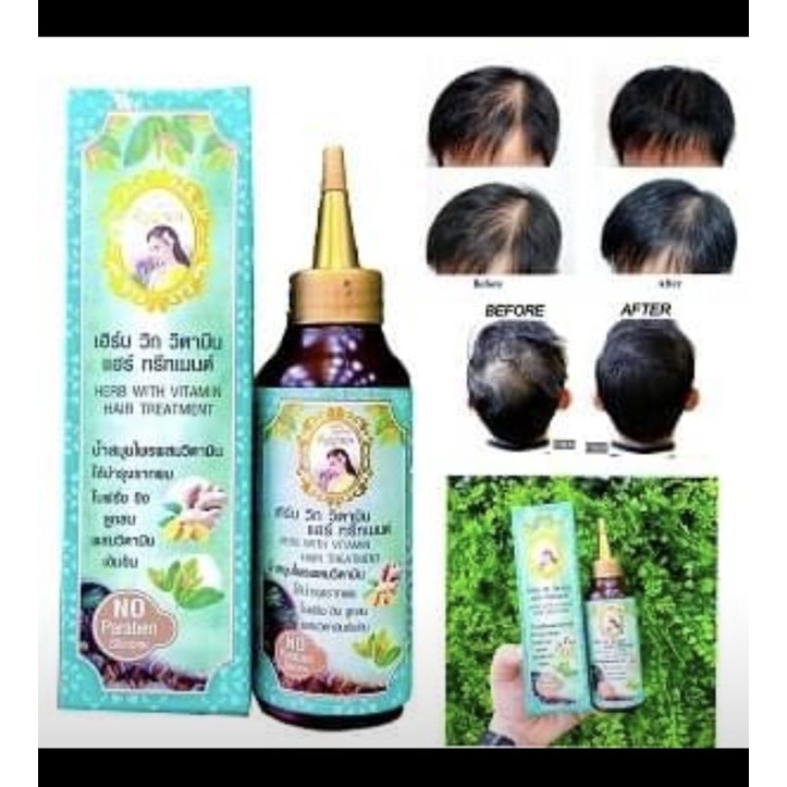 Hair Tonic Anyanang Herb With Vitamin Hair Treatment [Ori Thai 100%]