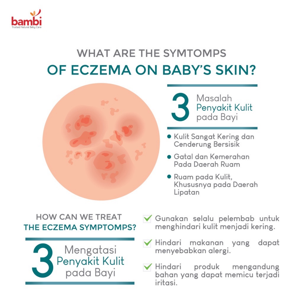 Bambi Dermacare Soothing &amp; Calming Theraphy Head To Toe Wash Sabun Shampoo Anak Bayi 200ml