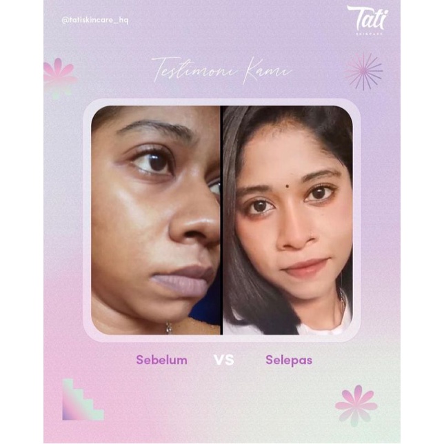 TATI skincare 5in1+ serum. original malaysia 100%