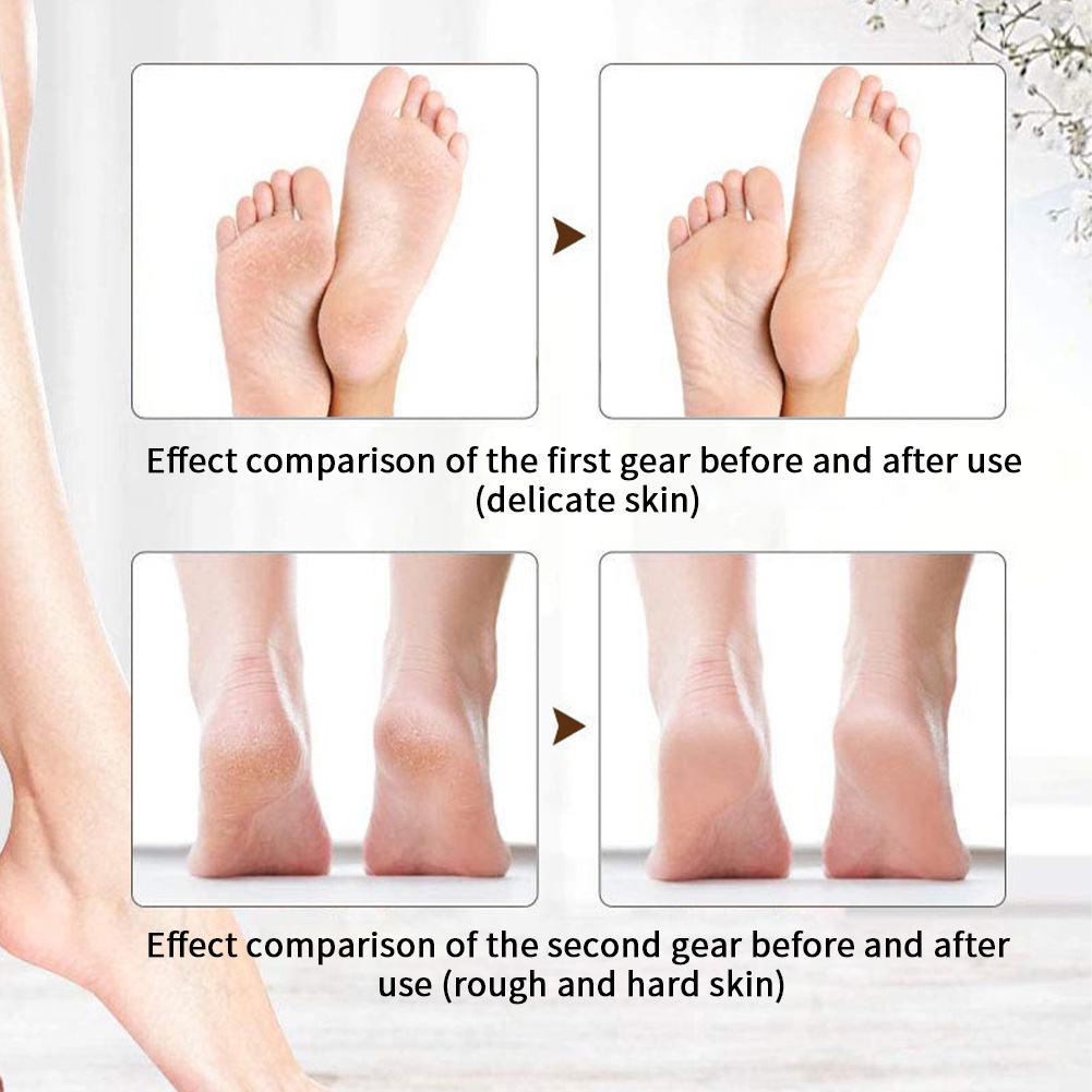 Penghalus Kaki Elektrik Untuk Kulit Mati Dan Kapalan Callus Remover Pedicure Menicure