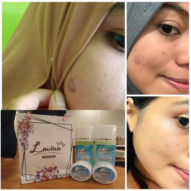 cream lavina skincare bpom