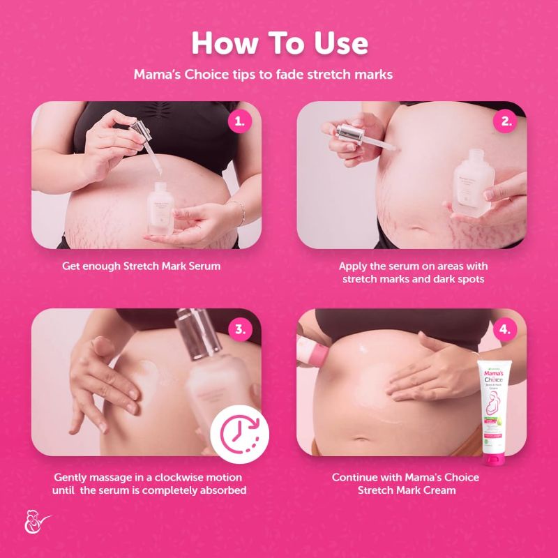 Stretch Mark Serum Mama's Choice untuk Ibu Hamil dan Menyusui (Solusi Perut Gatal dan Strech Mark)