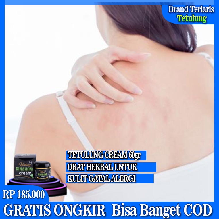 Cream Binahong 60gr, Salep Gatal Salep Kulit Gatal Alergi - Obat Gatal Jamur Kulit Kali Salep Kudis 