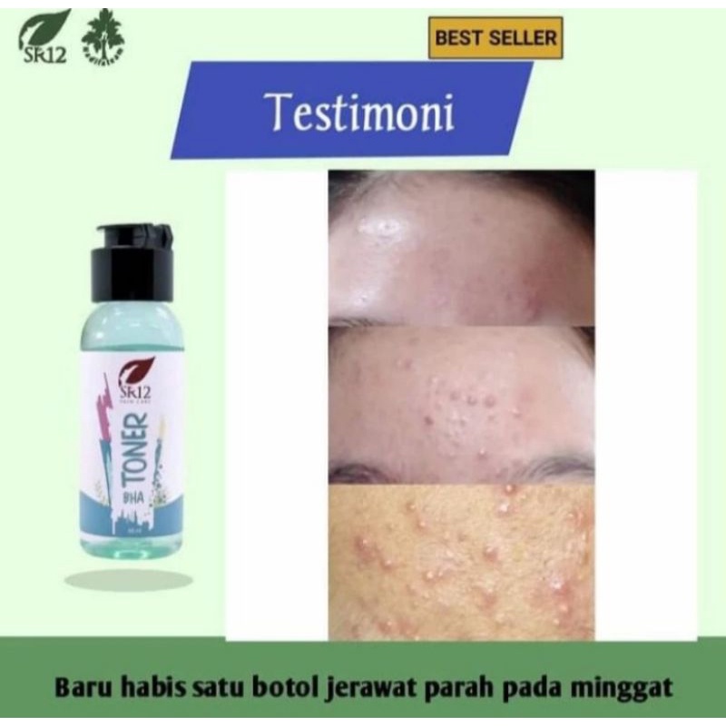 TONER BHA / TONER BHA SR12 / TONER VIRAL / TONER BAGUS / TONER GLOWING
