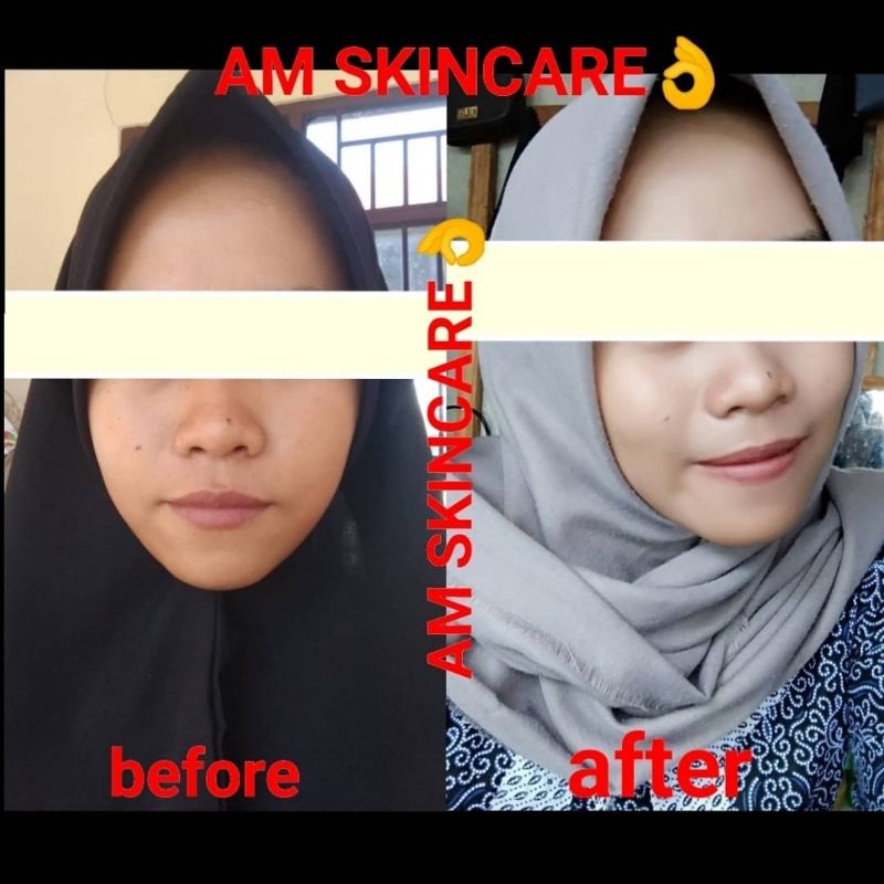 CREAM MALAM NORMAL WHITENING &amp; GLOWING BY AMSKINCARE | CREAM PEMUTIH DAN GLOWING