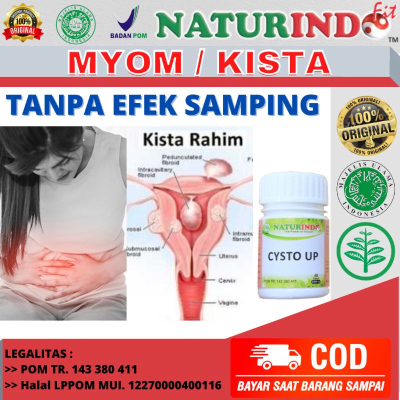 Obat Kista dan Miom Herbal Obat Kista Bartholin Kista Coklat Obat Kista Endometriosis Ampuh