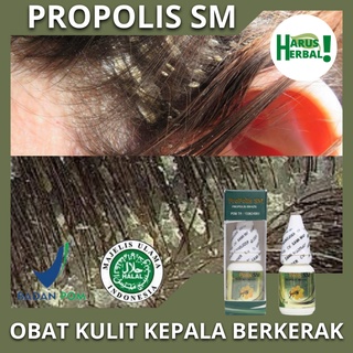 Kulit Kepala Kering Dan Mengelupas