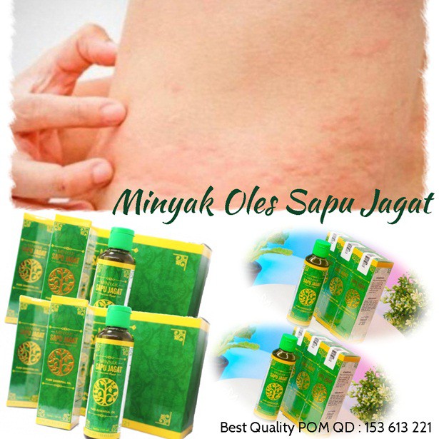 Jual Minyak Oles Gatal Kulit Obat Gatal Kulit Alami Obat Gatal Alami Untuk Anak Sapu Jagat Asli Indonesia Shopee Indonesia