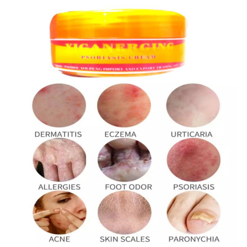 salep yiganerging eksim