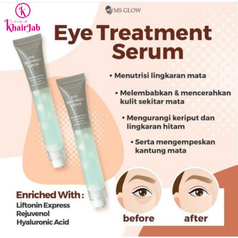 Eye Cream MS Glow/ Ms Glow Eye Treatment Serum