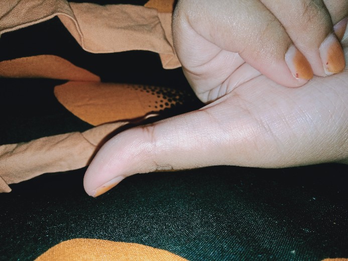 Kispray Refil 300 Ml (paket 2pc)