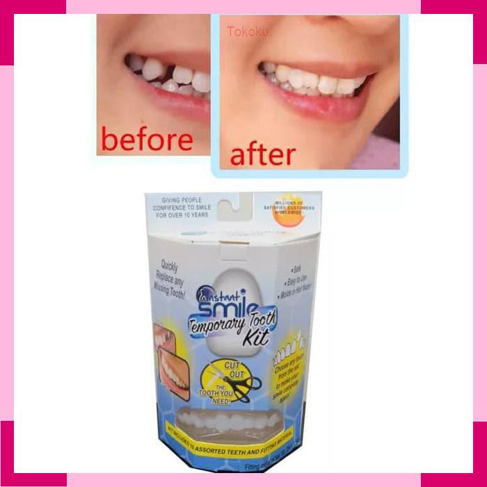 Gigi Palsu Instan Tempel Temporary Tooth Kit