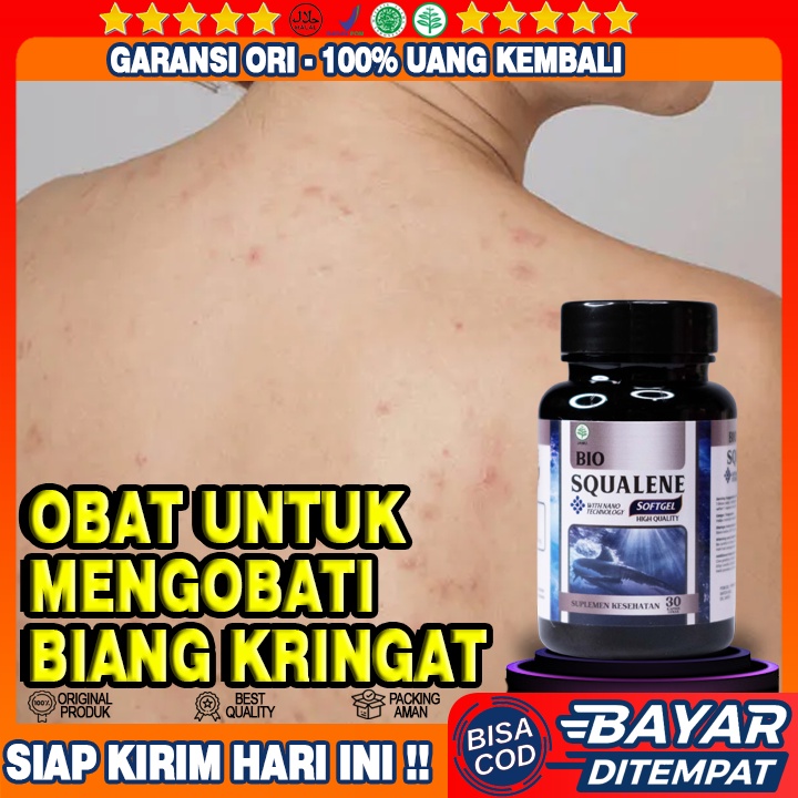 Obat Biang Keringat - Obat Biang Keringat Di Leher - Biang Keringat Gatal Gatal - Gatal Biang Kering
