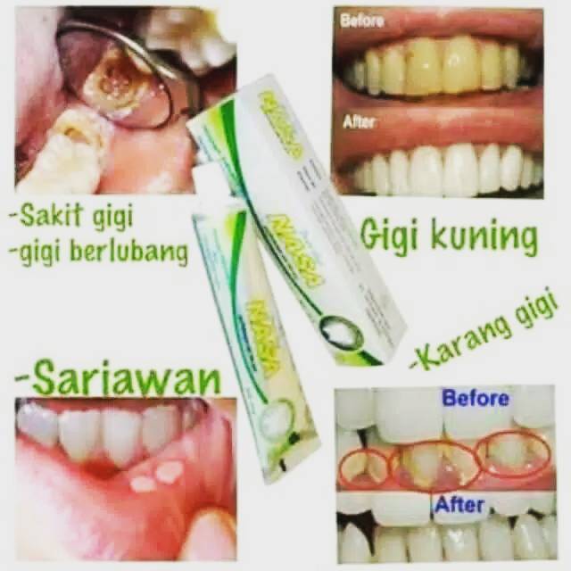 Pasta Gigi Nasa Asli Original 100%