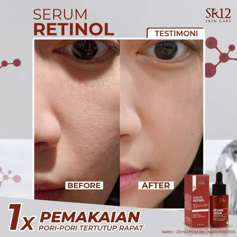SERUM RETINOL SR12 GLOWING / SERUM WAJAH/ SERUM RETINOL BPOM/SERUM VIRAL PENGHILANG JERAWAT/ SERUM ANTI AGING