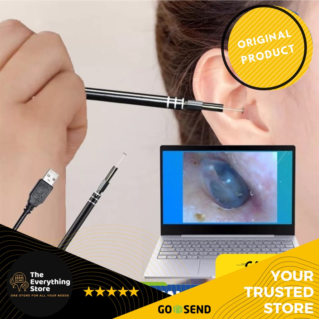 Korek Kuping Anak Dengan Kamera | Korek Kuping Dengan Kamera