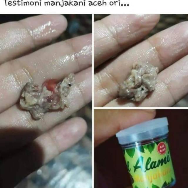 

Manjakani aceh
