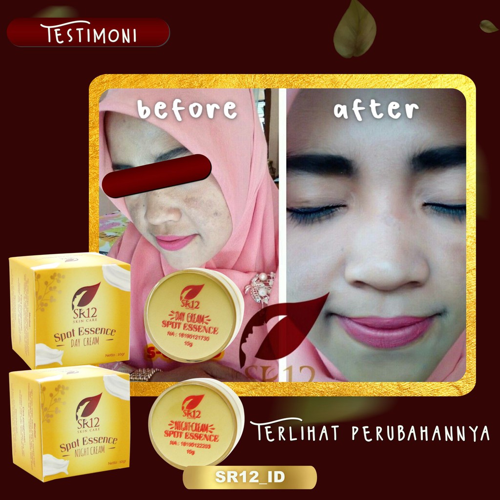 SPOT KRIM SR12 / SPOT ESSENCE CREAM SR12