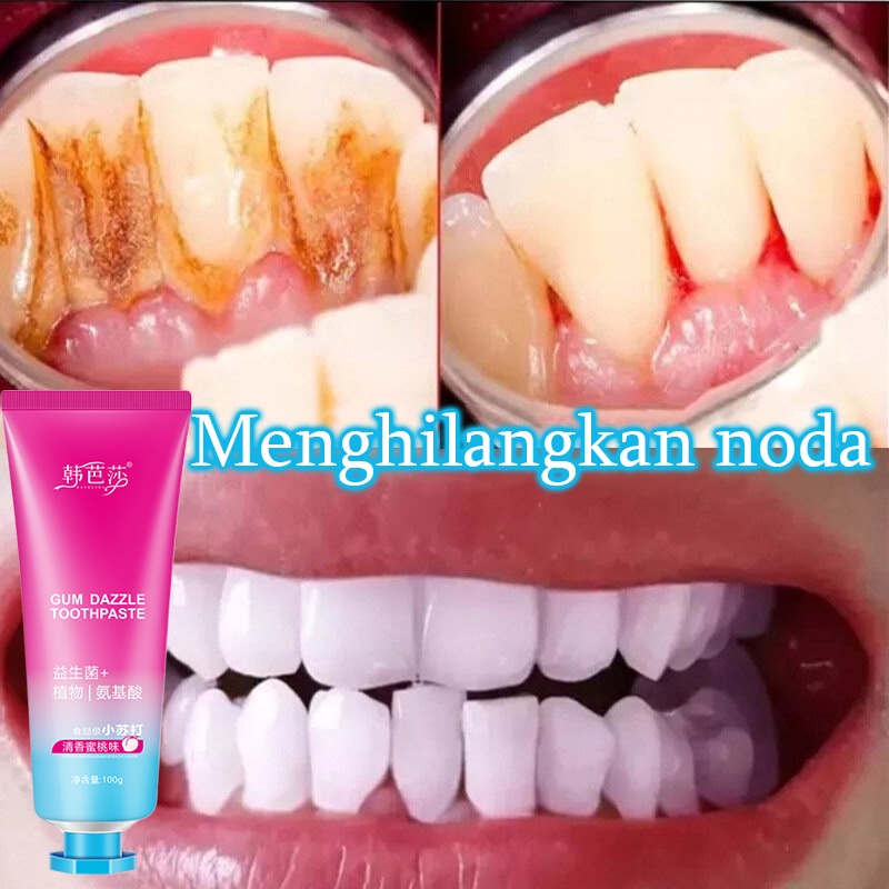 Teeth whitening Pasta gigi pemutih anak Toothpaste Memutihkan gigi 100G Menghilangkan noda teh Gigi kuning Plak Napas jernih melindungi gusi Jaga kebersihan mulut