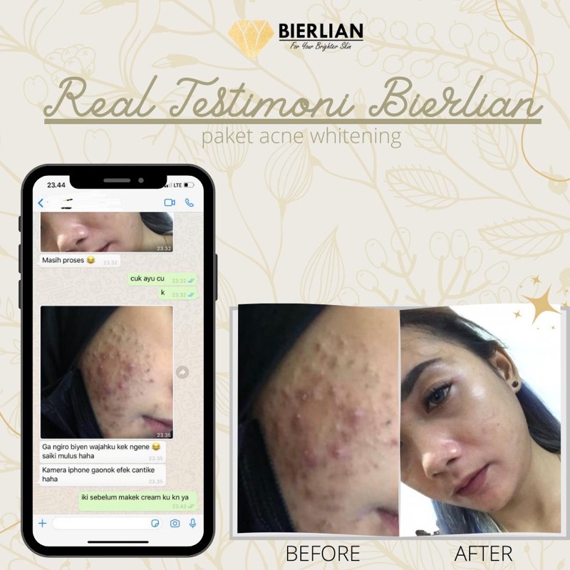 BIERLIAN SKINCARE CREAM WAJAH WHITE GLOW/SUPER WHITE/ACNE/FLEK [Free Pouch+Gift]-6