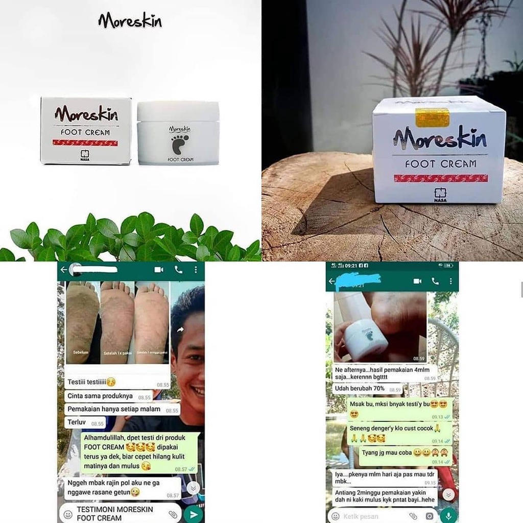 Obat kaki pecah2 - Obat kaki pecah dan kering - Food Cream Nasa - Cream kaki pecah2 - Kaki pecah2