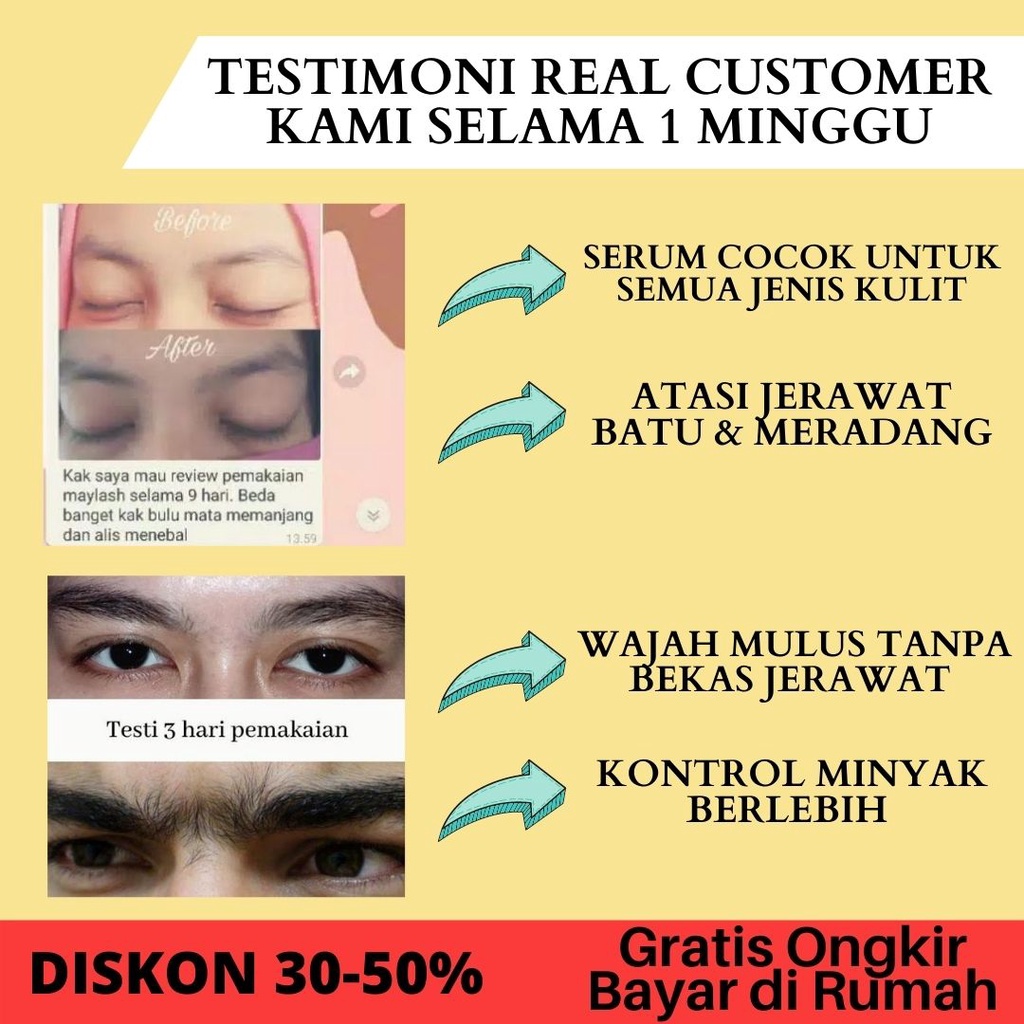 PENUMBUH ALIS KUNTZE CREAM ALIS BPOM - CREAM ALIS KUNTZE ORIGINAL BPOM