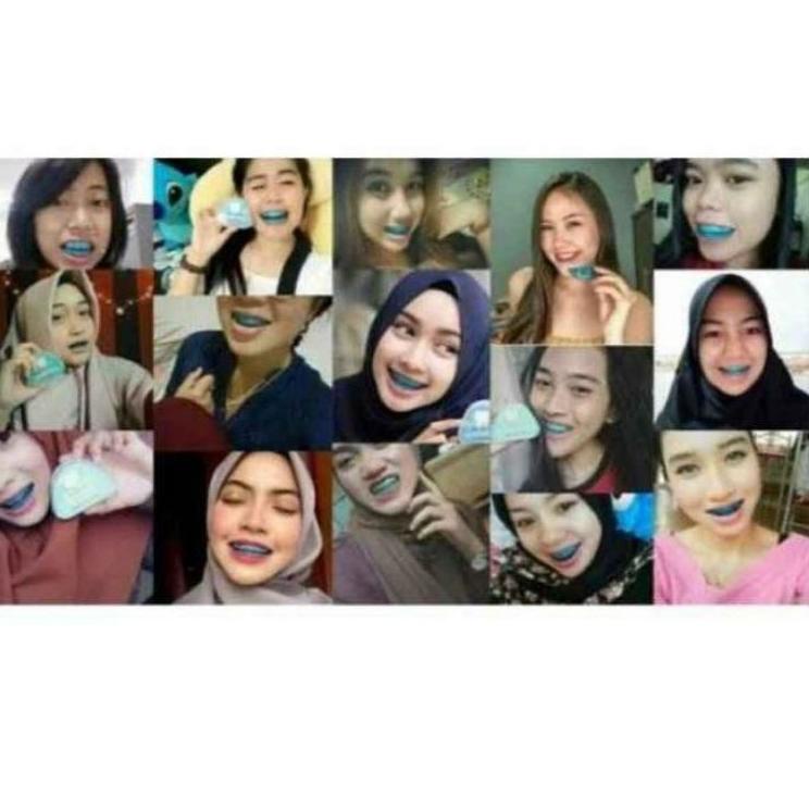 Harga TERMURAAH.. teeth trainer