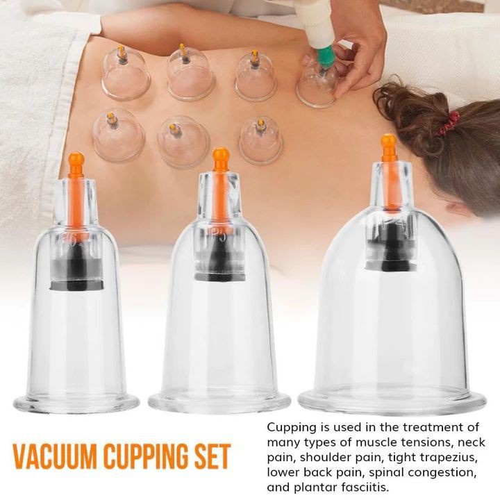 ALAT BEKAM KL KOP ANGIN 6PCS PULL OUT VACUUM CUPPING KIT