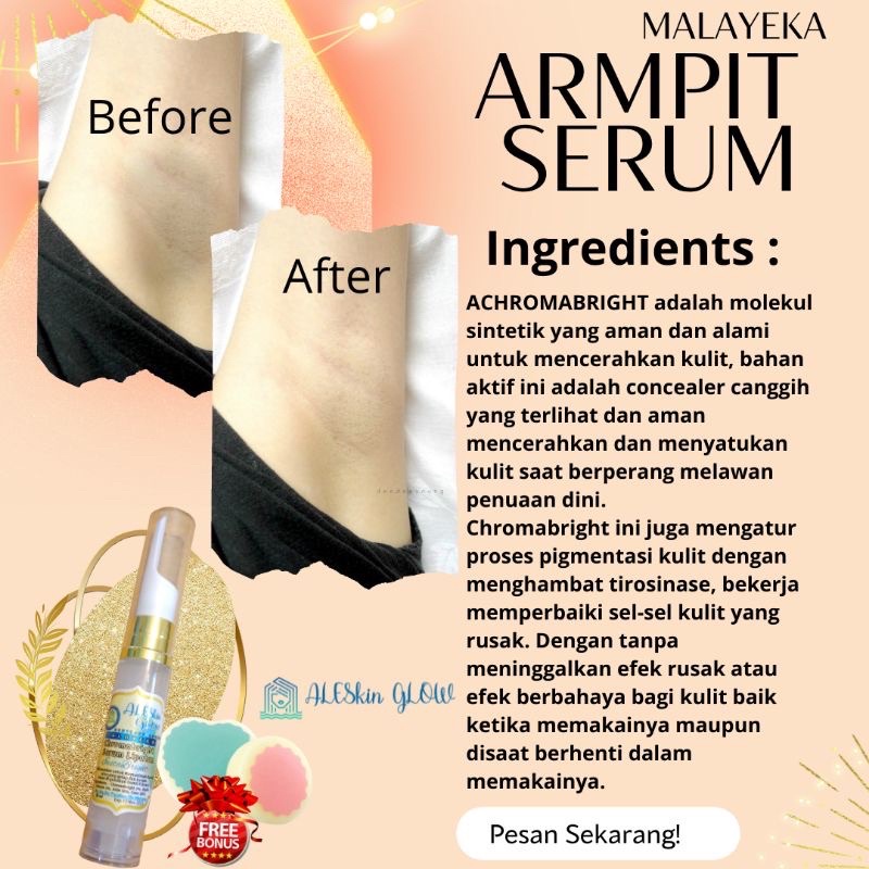 Pemutih Ketiak Ampuh Armpit Whitening Serum by Aleskin Glow