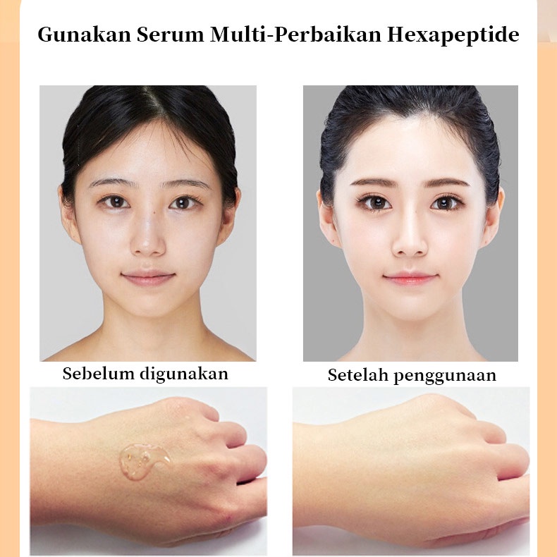 Serum Pemutih Wajah Serum Hexapeptide Serum Minyak Esensi Wajah Serum Noda Niacinamide Whitening Whitening Hexapeptide Brightening Acne Essence