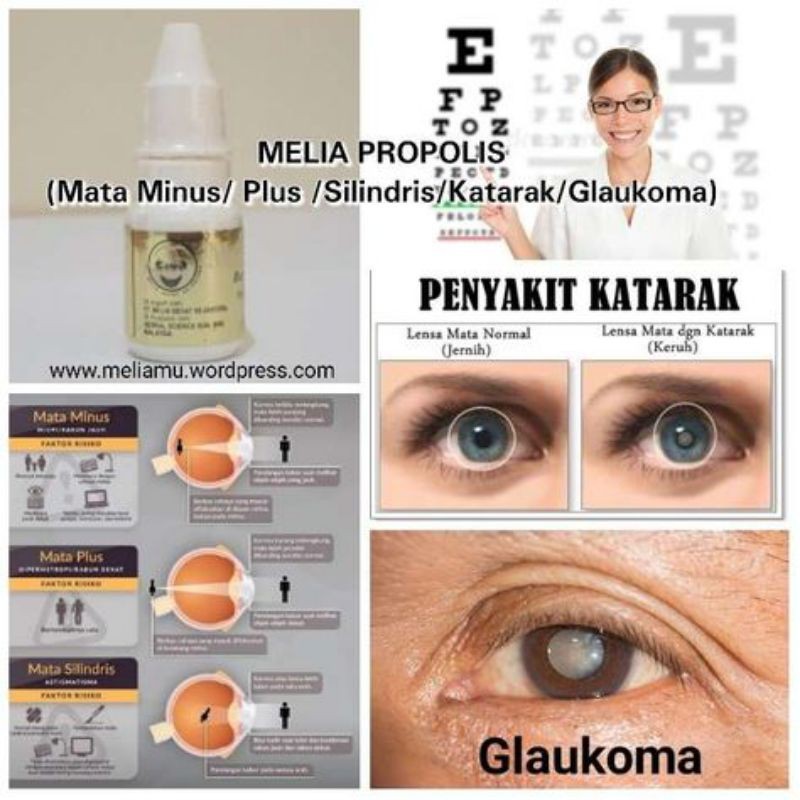 Obat Katarak Herbal Glaukoma Glucoma Propolis Melia