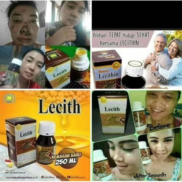 

Lecith