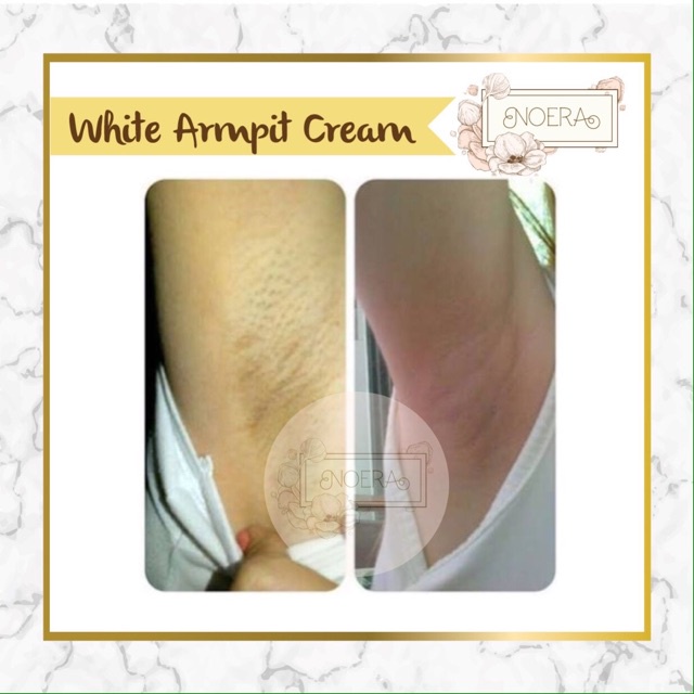 Noera Skin Lightening Cream | Armpit Cream Pemutih Lipatan BPOM / Noera Skin Lightening Cream, Pemutih Ketiak Underarm, Penghilang Bekas Luka