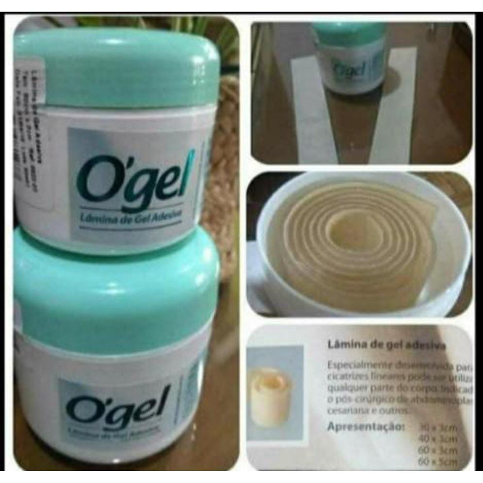 OGEL - Silicone Sheet Perawatan Bekas Luka Operasi Tummy Tuck Implant Payudara  Keloid 60 x 3 CM