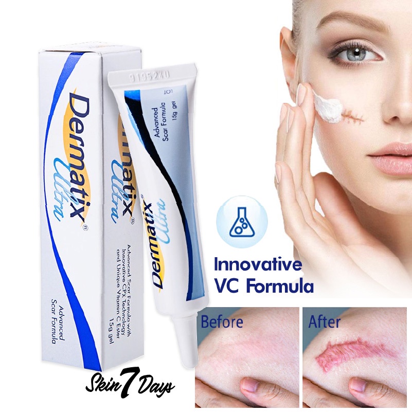 [ Dermatix Ultra ] Cream Penghilang Bekas Luka Operasi Iris Tergores Digigit Serangga Nyamuk / Luka Lama / Bakar / Gatal Hitam Koreng Di Kaki Oprasi Ampuh Advanced Scar Formula Gel Krim Wajah Keloid Stretchmark stretch mark Dermatik Dermatic Usa Original