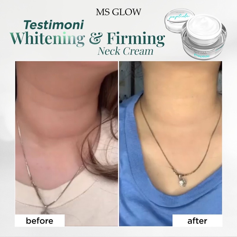 Whitening &amp; Firming Neck Cream Ms glow / Neck Cream ms glow / Cream leher / Whitening neck cream