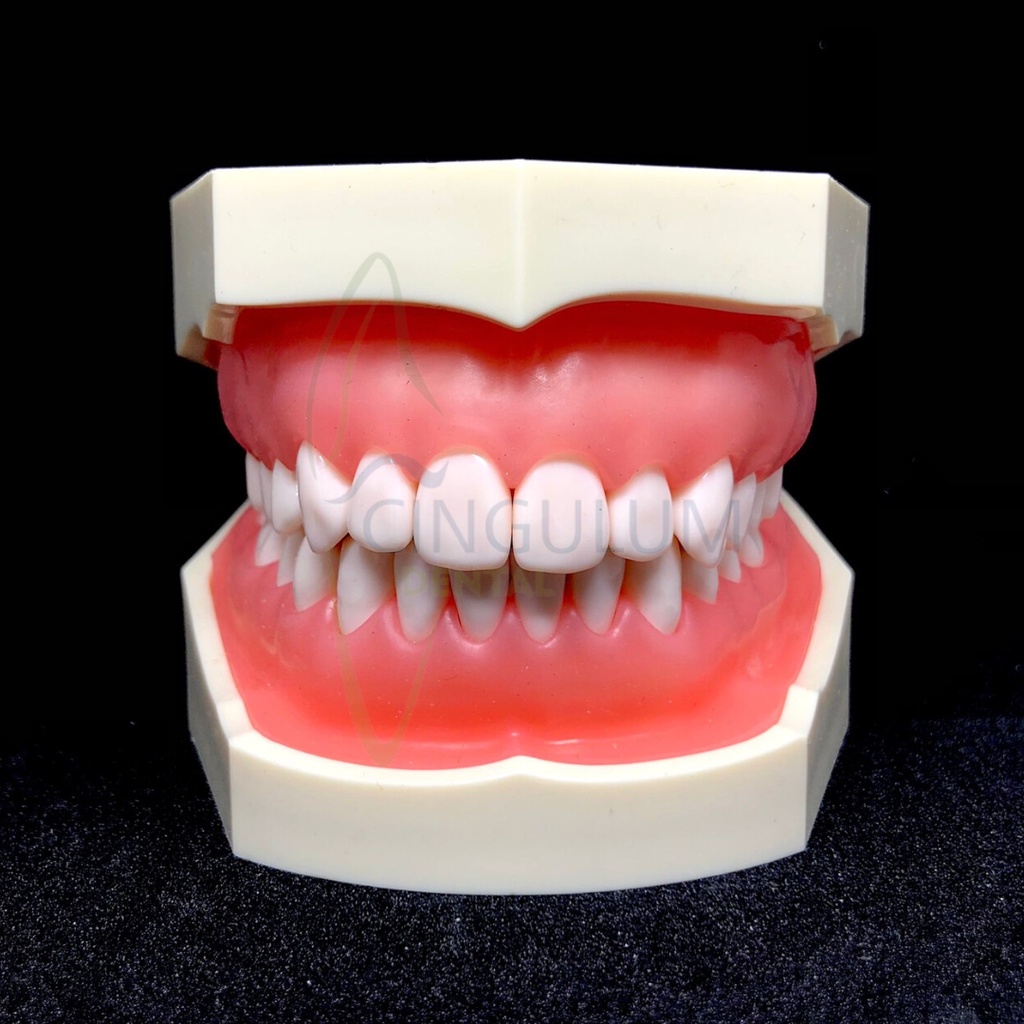Dental model study gigi peraga lepas pasang obeng baut / Model Gigi Typodont 28 Gigi Gingiva Elastis